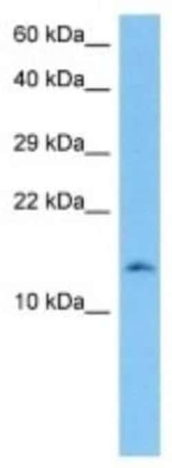 Hemoglobin beta 2 Rabbit anti-Mouse, Polyclonal, Novus Biologicals 100